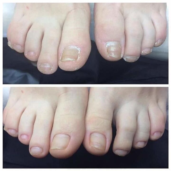 recenze použití Exodermin