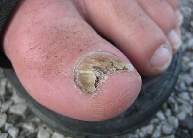 Výsledek zanedbávání