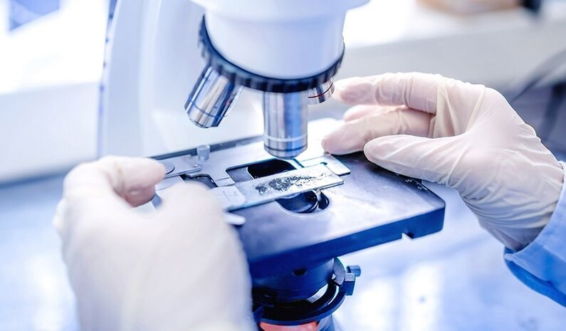 laboratorní diagnostika plísně nehtů na nohou