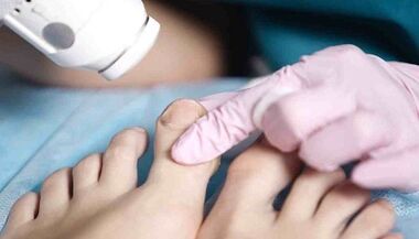 Hardwarové ošetření houby na nohou