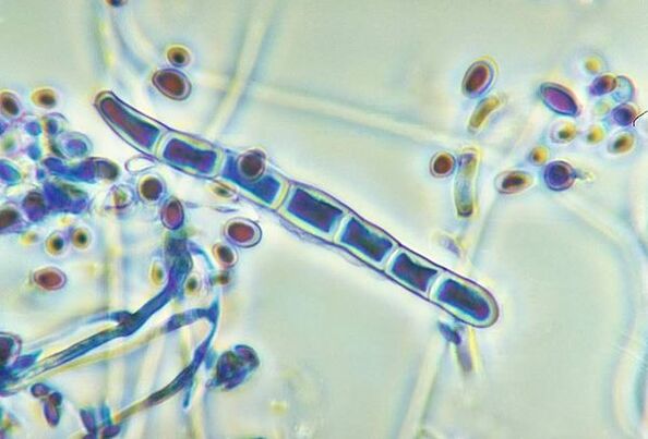 Houba Trichophyton rubrum pod mikroskopem